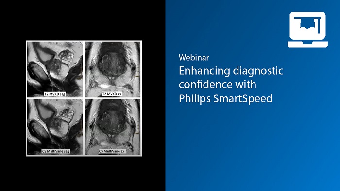 Webinar: Enhancing diagnostic confidence at the University Clinic Bonn with Philips SmartSpeed