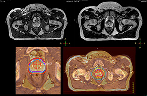 magnetic resonance thumbnail