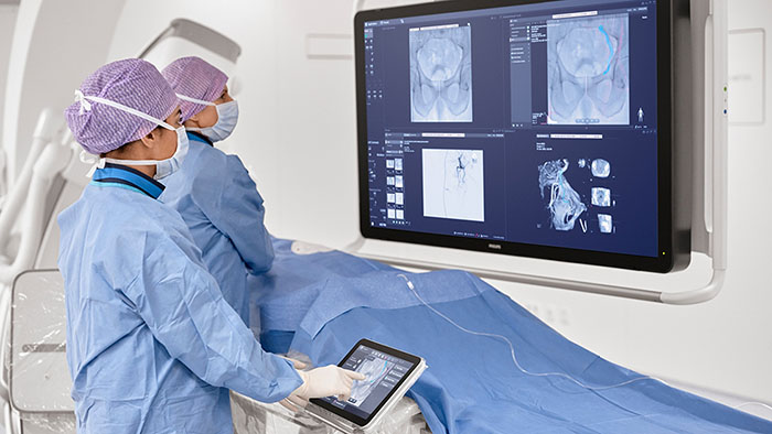 PreciseOnco research consortium awarded EUR 14.9 million IHI grant to drive breakthroughs in precision cancer treatment