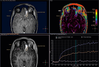 image for mr permeability