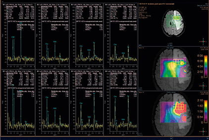 image for mr spectroview