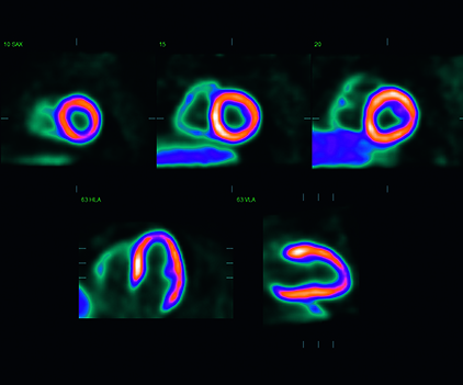 image for cedars sinai cardiac suite