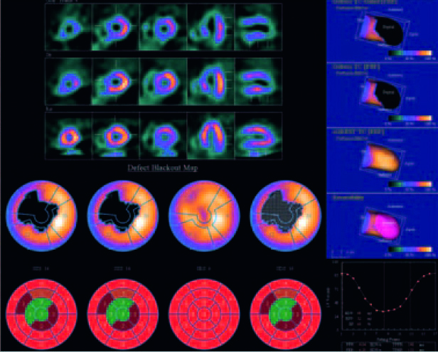 image for corridor 4dm