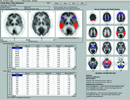 image for nm neuro q