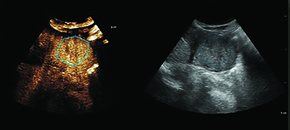 image for us q app region of interest roi